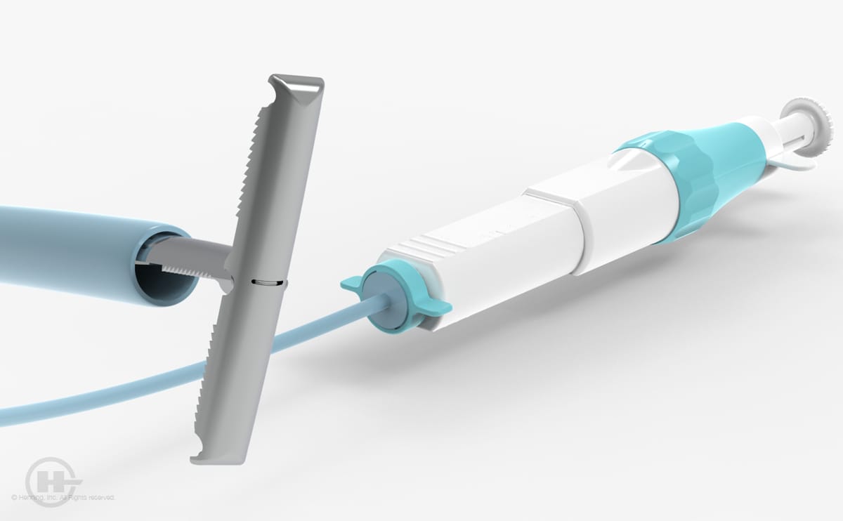 Tricuspid Valve Repair